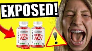 Ultimate Guide to Keto ACV Gummies for Weight Loss: Insights and Reviews for Supreme Results [168419a4e]