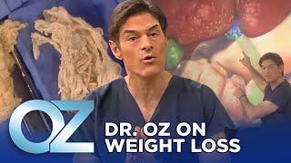 Weight Loss Gummies - Dr. Oz on Weight Loss | Oz Weight Loss [6de57b4b2]