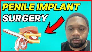 Penile Implant Side Effects Serious Information Watch This Now