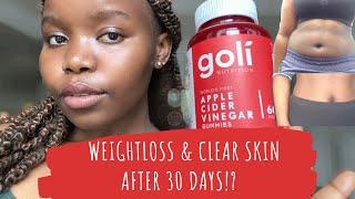 Weight Loss Gummies - Goli gummies review | weightloss, clearskin and more [d6b76a7b0]