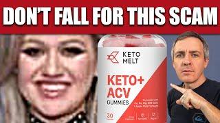 Weight Loss Gummies - Keto Melt Keto + ACV Gummies Weight Loss Scam with Kelly Clarkson and Fake Reviews, Explained [e25c0928c]